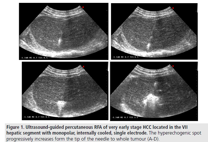 imaging-medicine-progressively-increases
