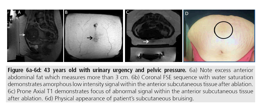 imaging-medicine-urinary-urgency-pelvic-pressure