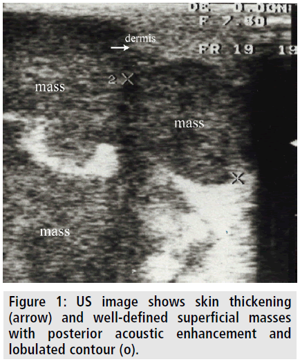 imaging-medicine-us-image-shows-skin