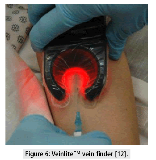 imaging-medicine-veinlite-vein-finder