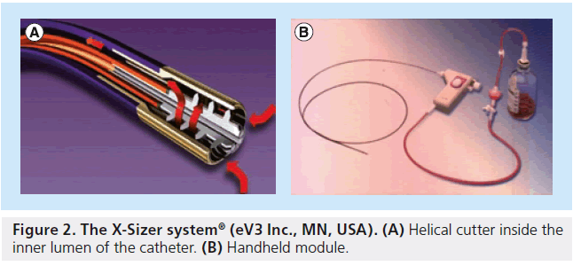 interventional-Helical-cutter