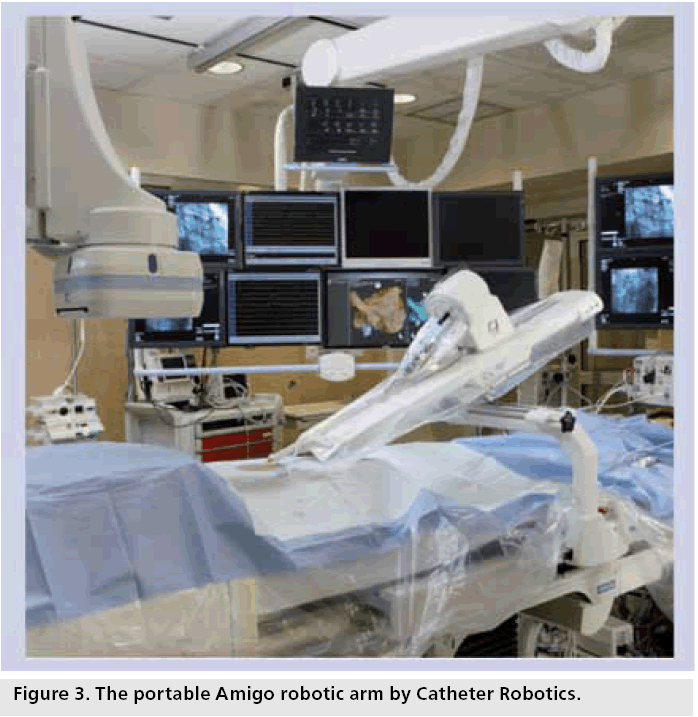 interventional-cardiology-Amigo-robotic-arm