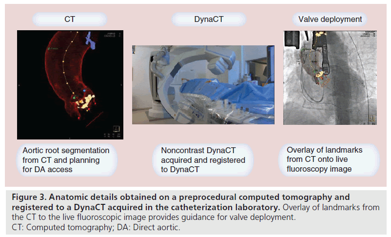 interventional-cardiology-Anatomic-details