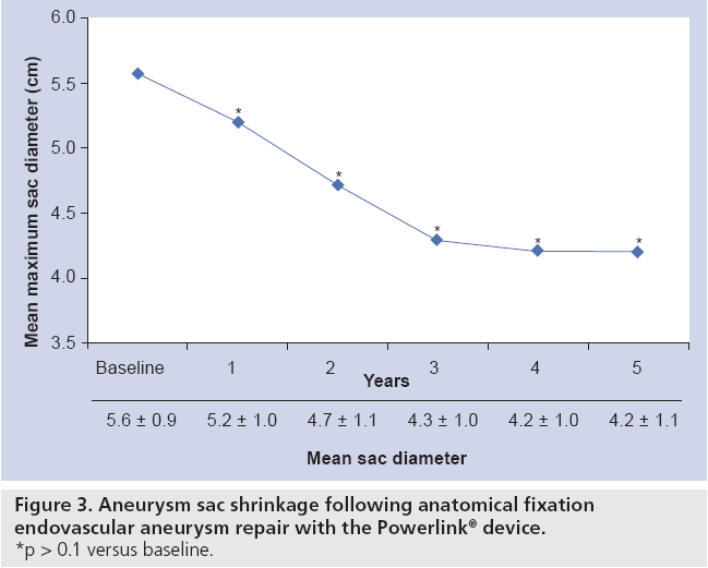 interventional-cardiology-Aneurysm-sac-shrinkage