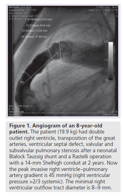 interventional-cardiology-Angiogram