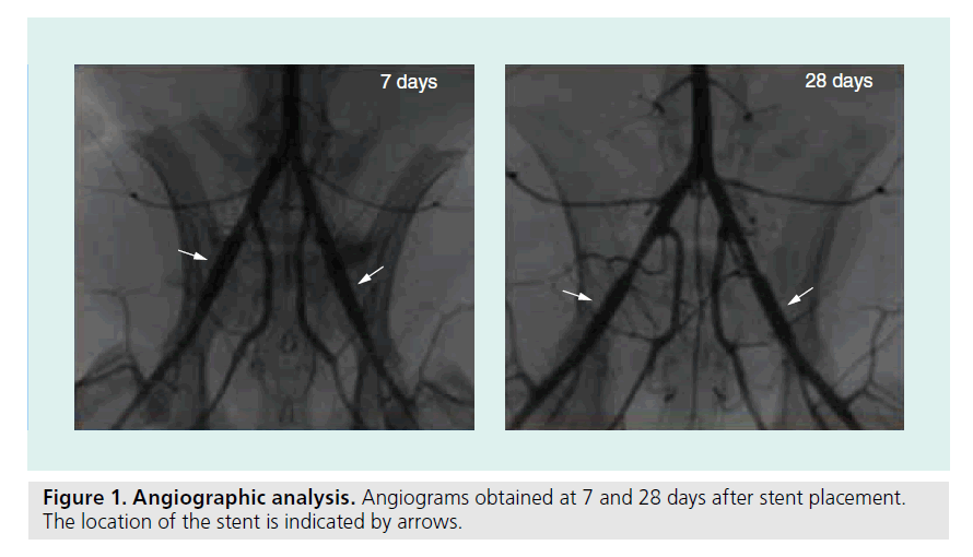 interventional-cardiology-Angiographic-analysis