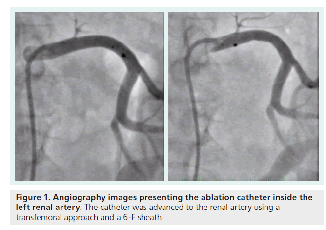 interventional-cardiology-Angiography-images