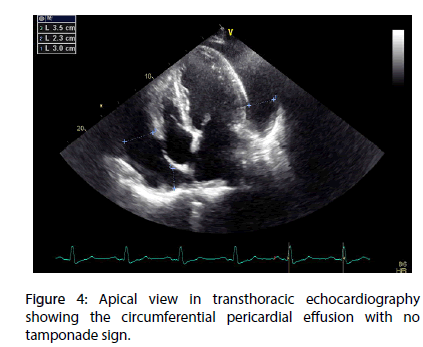 interventional-cardiology-Apical-view