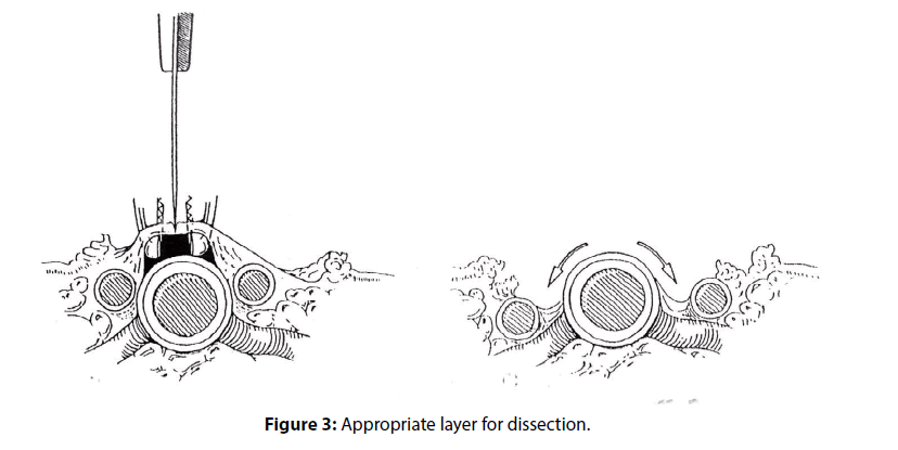 interventional-cardiology-Appropriate-layer