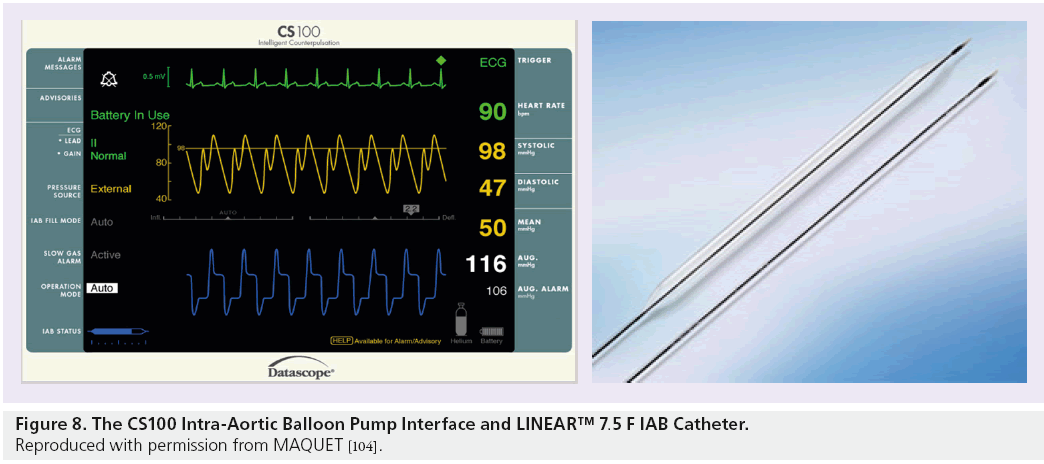 interventional-cardiology-Balloon-Pump-Interface
