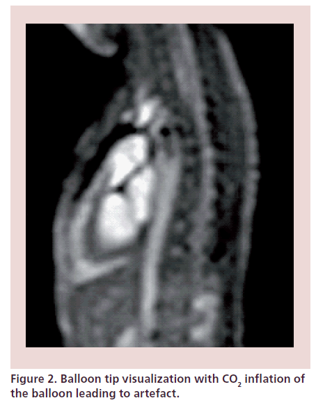 interventional-cardiology-Balloon-tip