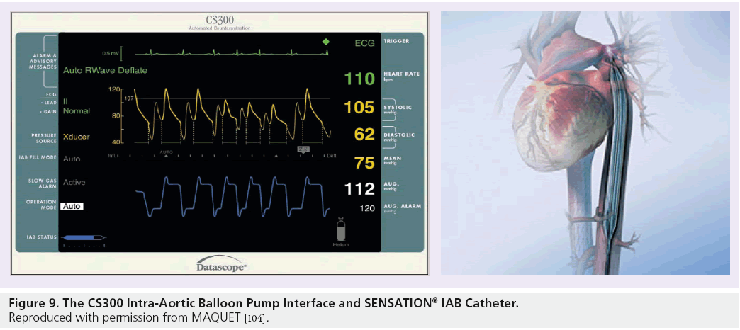 interventional-cardiology-CS300-Intra-Aortic