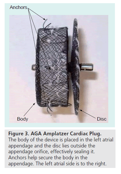 interventional-cardiology-Cardiac-Plug