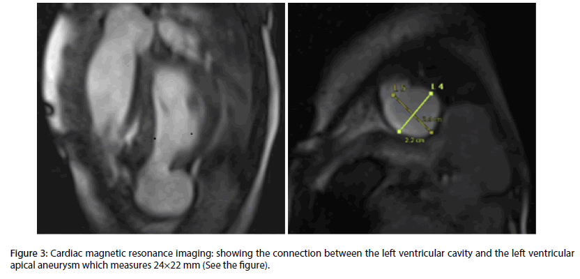 interventional-cardiology-Cardiac-magnetic