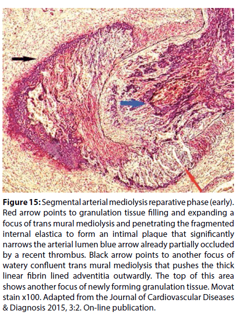 interventional-cardiology-Cardiovascular-Diseases