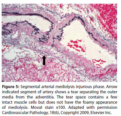 interventional-cardiology-Cardiovascular-Pathology