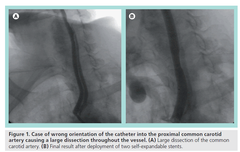 interventional-cardiology-Case-wrong