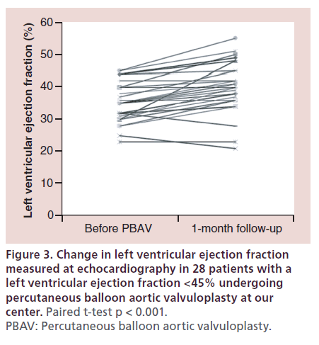 interventional-cardiology-Change-left-ventricular