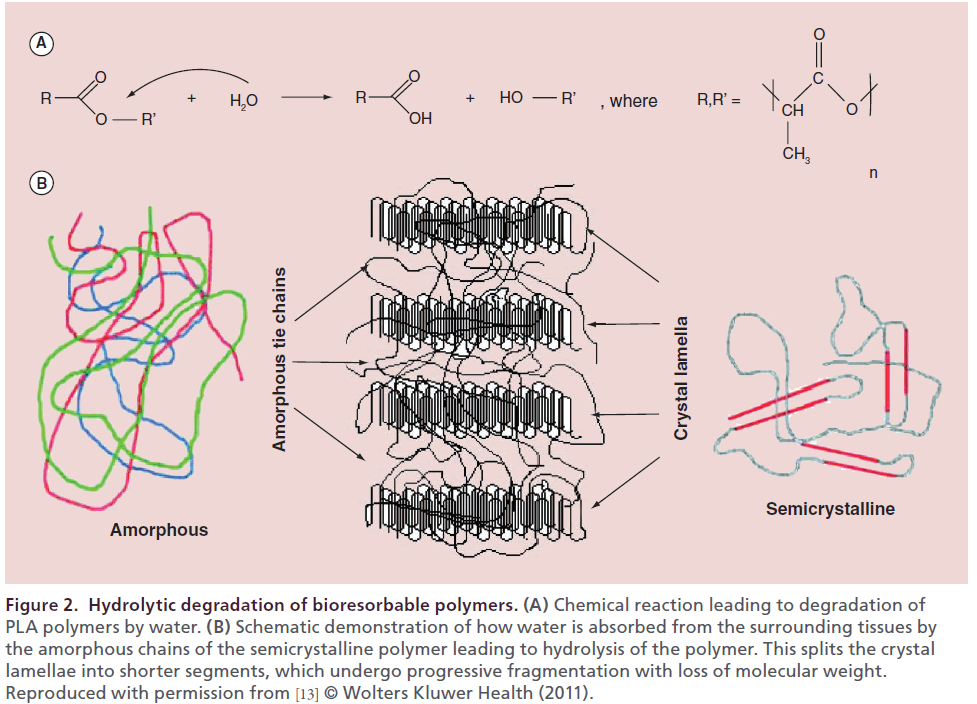 interventional-cardiology-Chemical