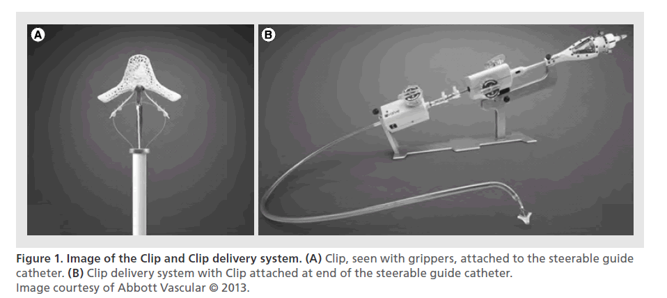 interventional-cardiology-Clip-delivery