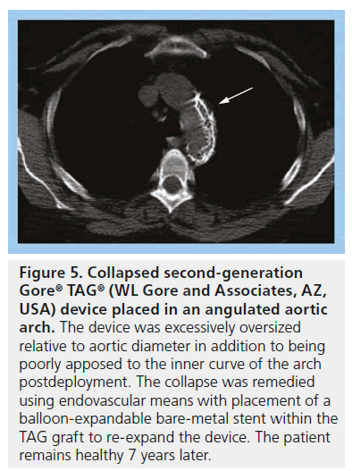 interventional-cardiology-Collapsed-second