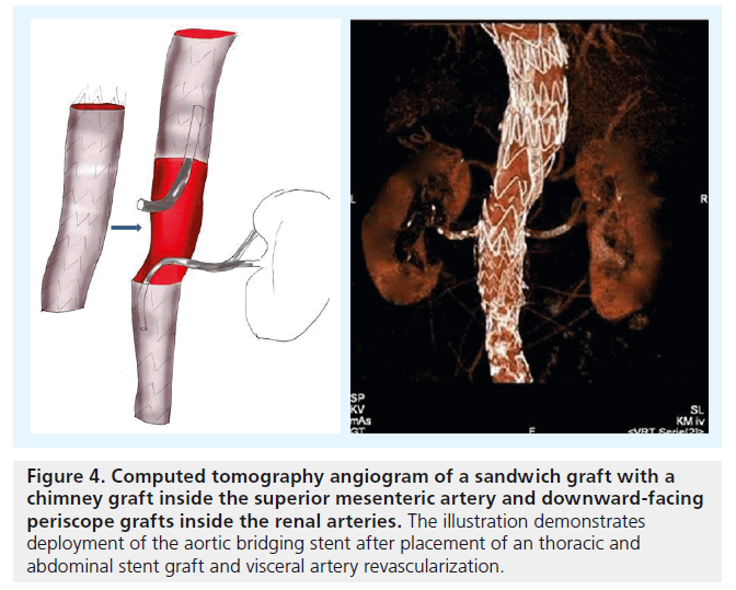 interventional-cardiology-Computed-tomography