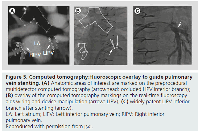 interventional-cardiology-Computed-tomography
