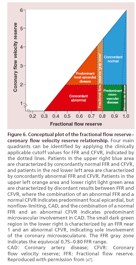 interventional-cardiology-Conceptual-plot