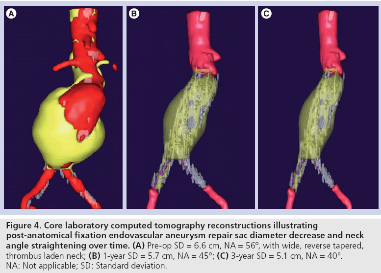 interventional-cardiology-Core-laboratory-computed