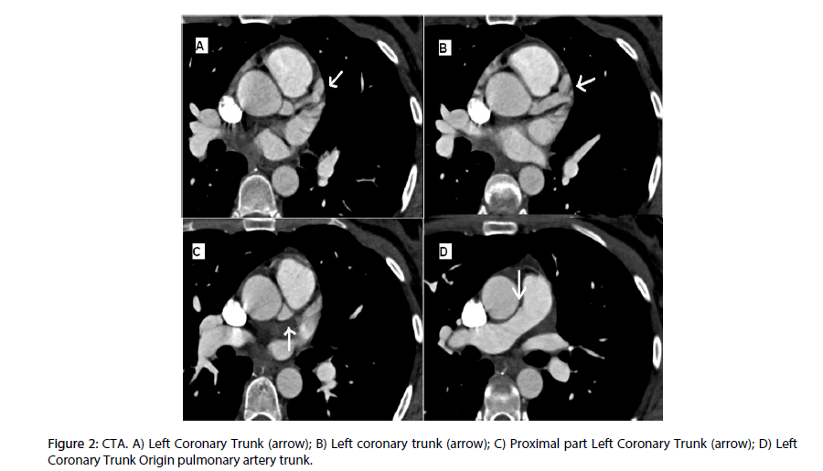 interventional-cardiology-Coronary-Trunk