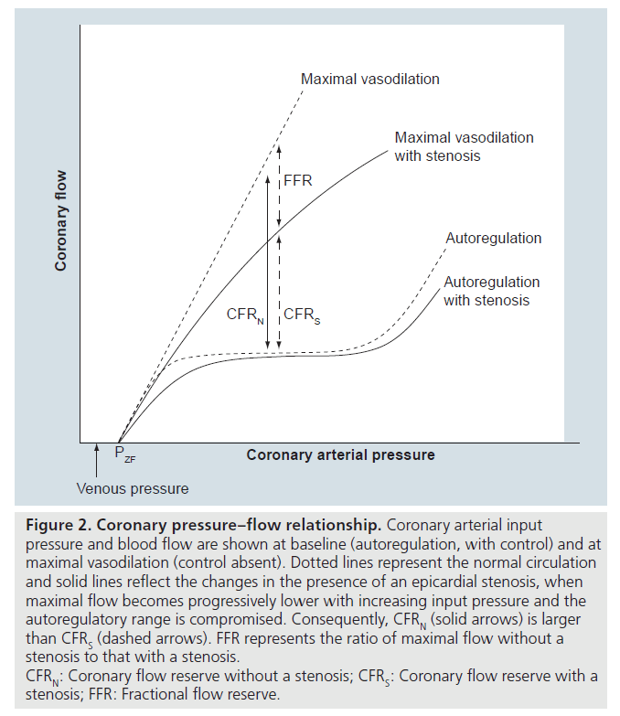 interventional-cardiology-Coronary-pressure