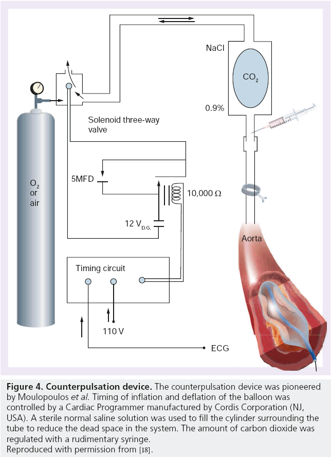 interventional-cardiology-Counterpulsation-device