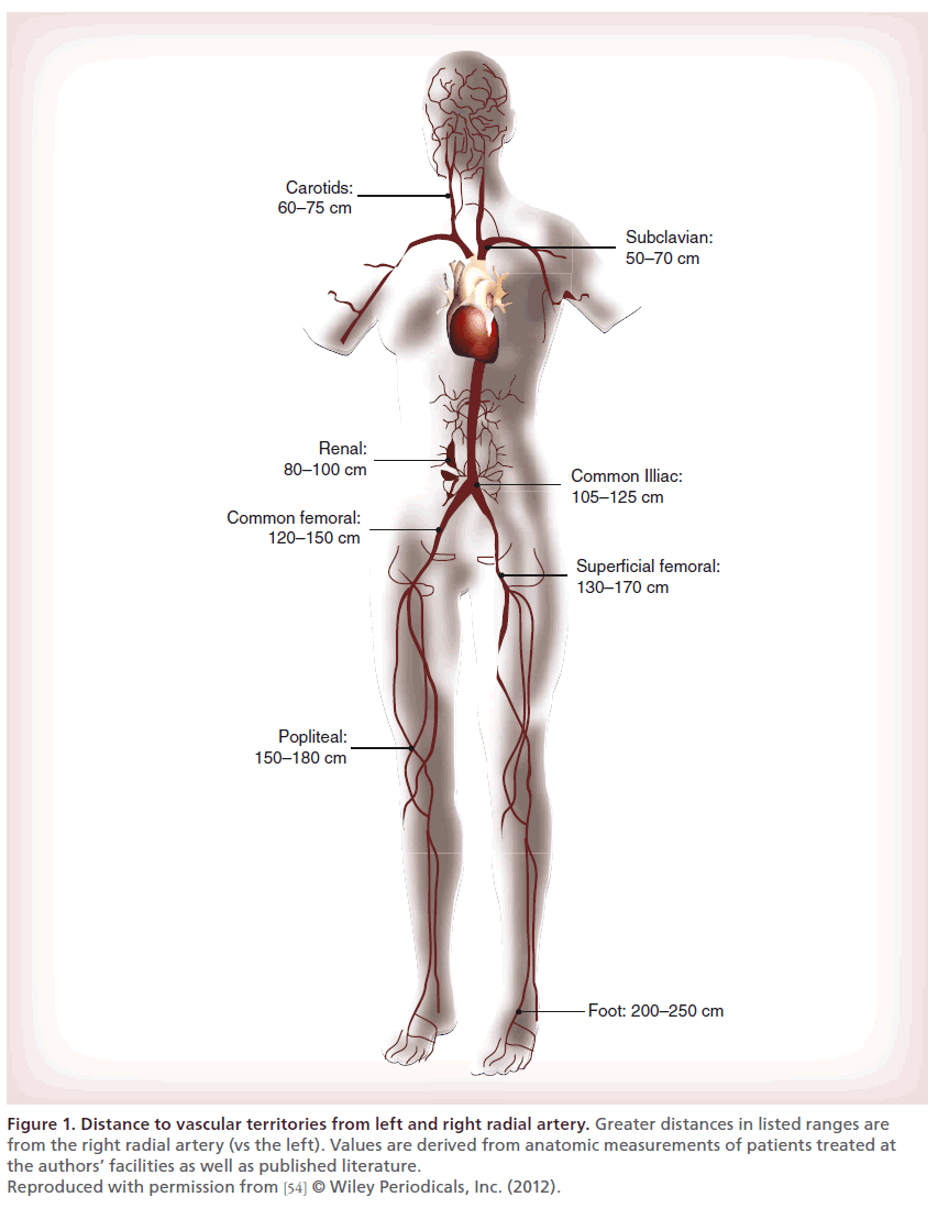 interventional-cardiology-Distance-vascular-territories