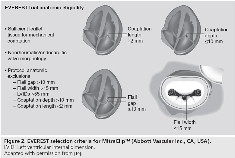 interventional-cardiology-EVEREST-selection-criteria