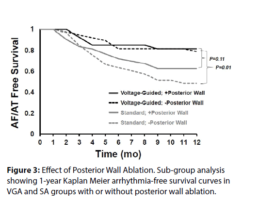 interventional-cardiology-Effect-Posterior-Wall-Ablation