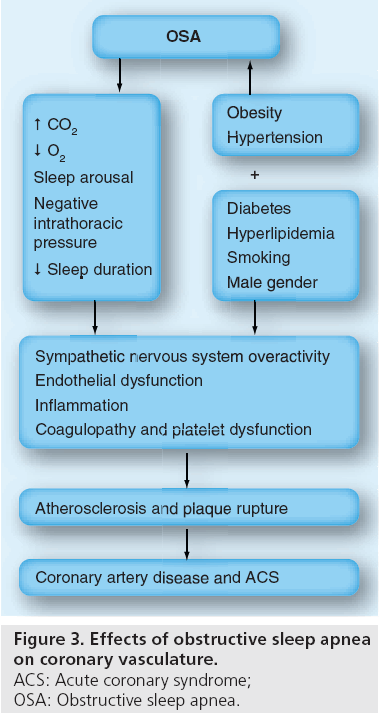interventional-cardiology-Effects-obstructive-sleep