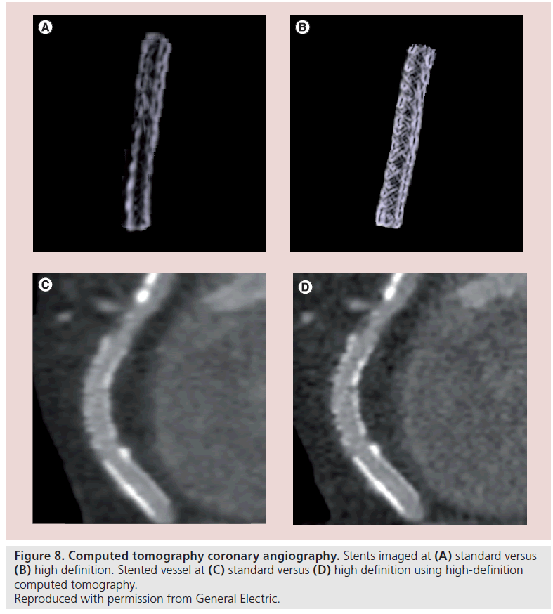 interventional-cardiology-Electric