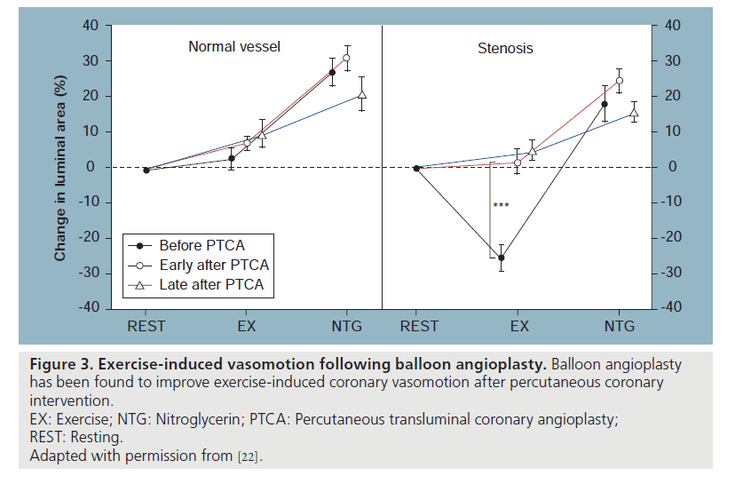 interventional-cardiology-Exercise-induced