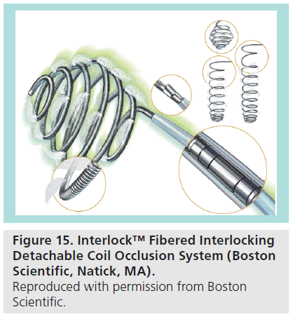 interventional-cardiology-Fibered-Interlocking