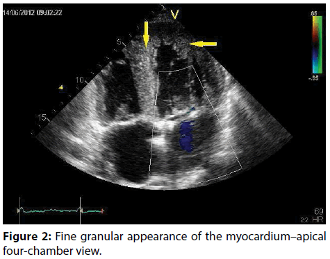 interventional-cardiology-Fine-granular