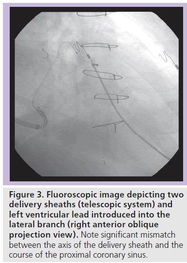 interventional-cardiology-Fluoroscopic-image