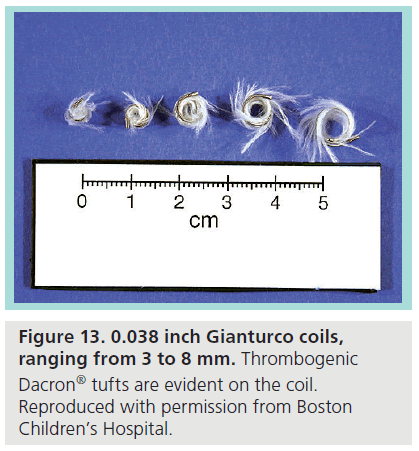 interventional-cardiology-Gianturco-coils