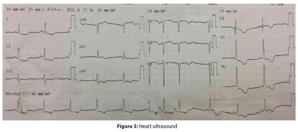 interventional-cardiology-Heart-ultrasound