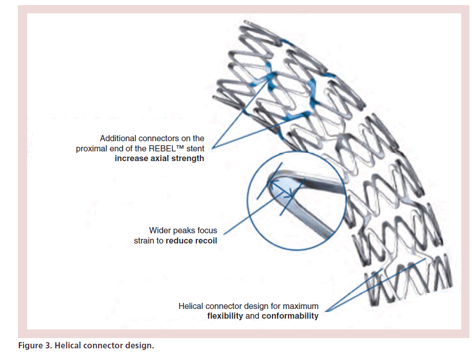 interventional-cardiology-Helical-connector