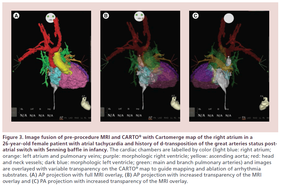 interventional-cardiology-Image-fusion-pre-procedure