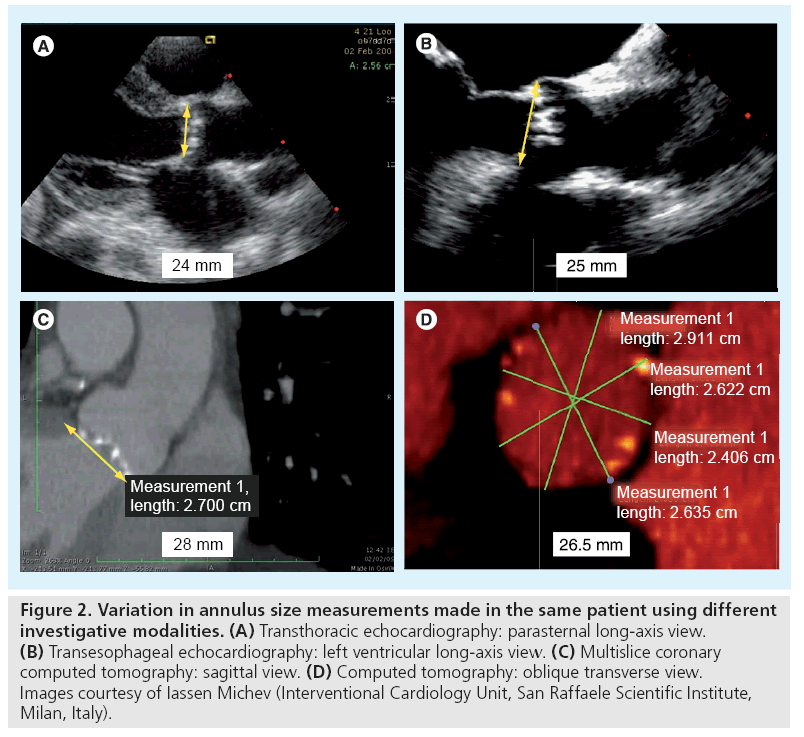 interventional-cardiology-Images-courtesy