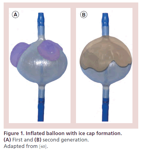 interventional-cardiology-Inflated-balloon