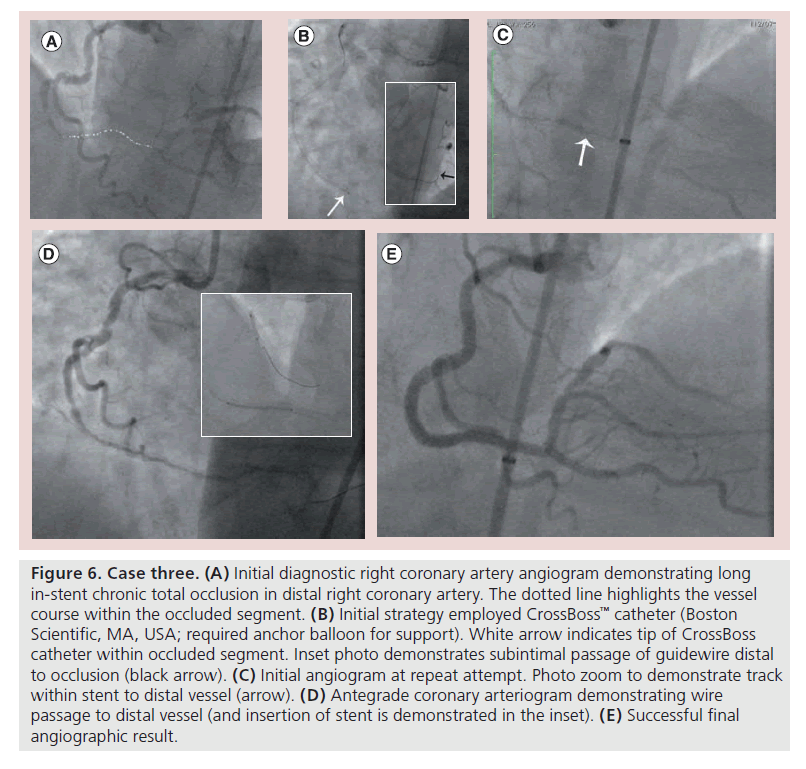 interventional-cardiology-Initial-diagnostic