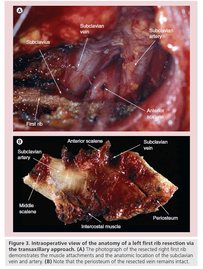 interventional-cardiology-Intraoperative-view