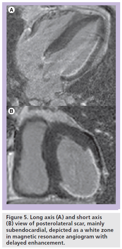 interventional-cardiology-Long-axis